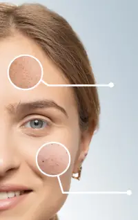 AI beneath the skin