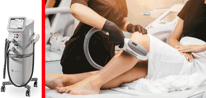 Laser Hair Removal